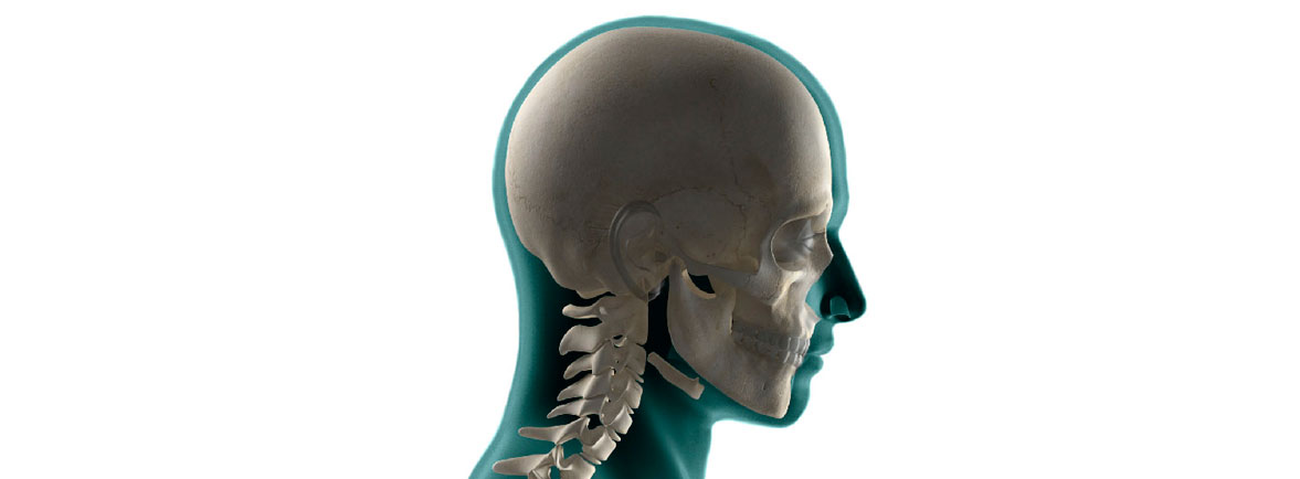 Disociacion craniocervical