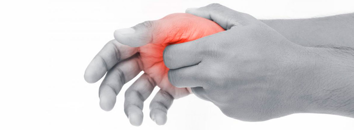 Tenosinovitis de Quervain - Inflamación de los tendones abductores del dedo pulgar Tenosinovitis de Quervain