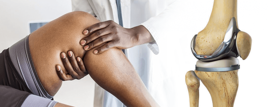 Cuanto dura una protesis de rodilla