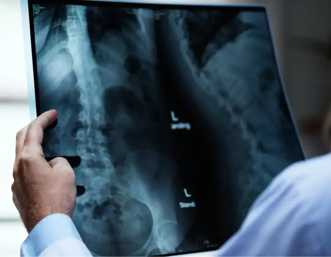 Radiografía de cadera evaluada por un especialista